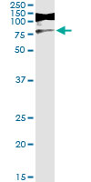 5 - RIOK3 Antibody (monoclonal) (M01) AT3644a