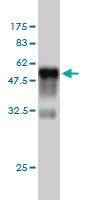 1 - RIT2 Antibody (monoclonal) (M01) AT3648a