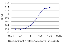10 - RLBP1 Antibody (monoclonal) (M01) AT3649a
