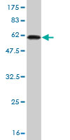 1 - RLBP1 Antibody (monoclonal) (M01) AT3649a