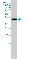 1 - RLBP1 Antibody (monoclonal) (M02) AT3650a