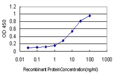 10 - RNASEL Antibody (monoclonal) (M01) AT3654a