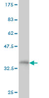 1 - RNF141 Antibody (monoclonal) (M01) AT3667a