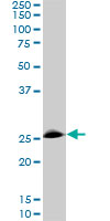 1 - RNF141 Antibody (monoclonal) (M01) AT3667a