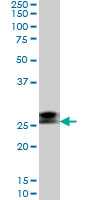 1 - RNF141 Antibody (monoclonal) (M01) AT3667a