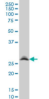 1 - RNF141 Antibody (monoclonal) (M01) AT3667a