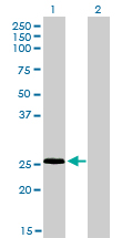 1 - RNF141 Antibody (monoclonal) (M01) AT3667a