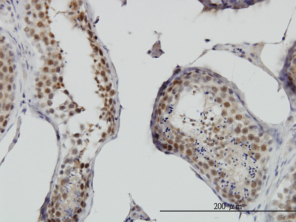 2 - RNF141 Antibody (monoclonal) (M01) AT3667a
