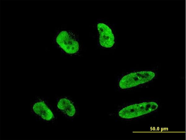 3 - RNF151 Antibody (monoclonal) (M02) AT3668a