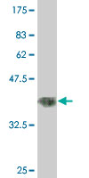 1 - RNF151 Antibody (monoclonal) (M02) AT3668a