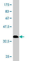 1 - RNF26 Antibody (monoclonal) (M01) AT3675a