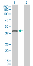1 - RNF26 Antibody (monoclonal) (M01) AT3675a