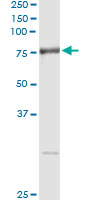 5 - RNPEP Antibody (monoclonal) (M02) AT3681a
