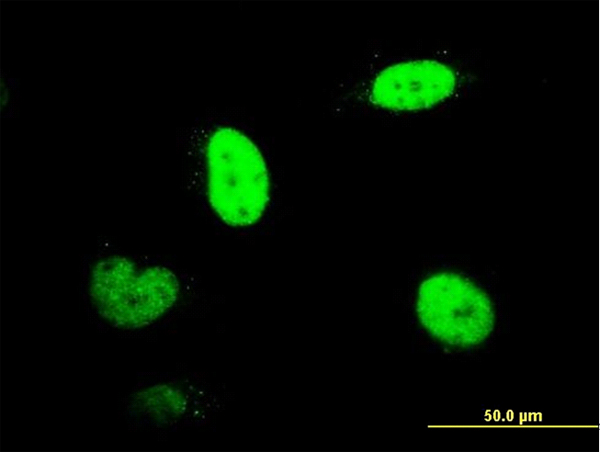 3 - RNUT1 Antibody (monoclonal) (M01) AT3683a