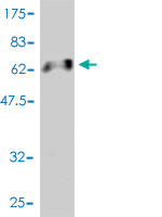 1 - RNUT1 Antibody (monoclonal) (M01) AT3683a