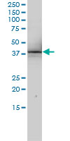1 - RNUT1 Antibody (monoclonal) (M01) AT3683a