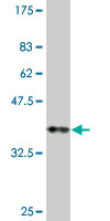 1 - ROBO2 Antibody (monoclonal) (M01) AT3685a