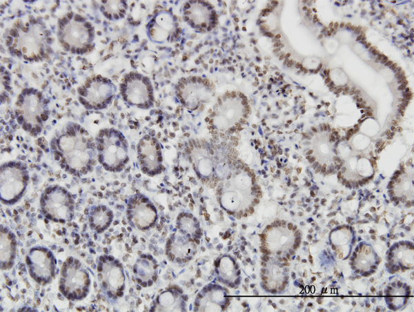 2 - ROD1 Antibody (monoclonal) (M01) AT3689a
