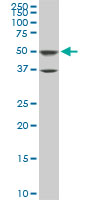1 - ROD1 Antibody (monoclonal) (M01) AT3689a