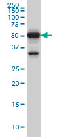 1 - ROD1 Antibody (monoclonal) (M01) AT3689a