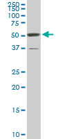 1 - ROD1 Antibody (monoclonal) (M01) AT3689a