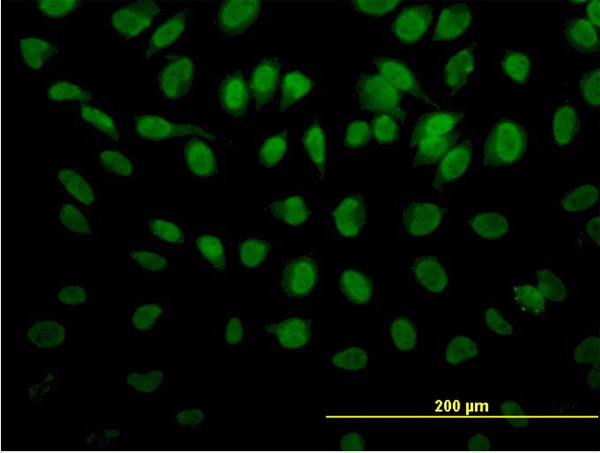 3 - ROD1 Antibody (monoclonal) (M01) AT3689a