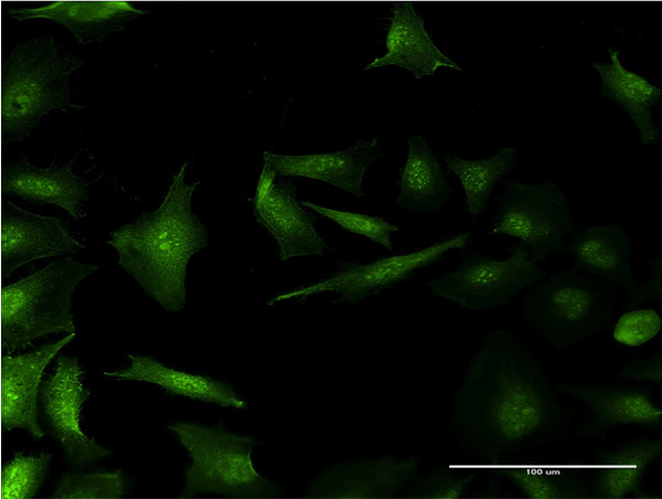3 - RP2 Antibody (monoclonal) (M01) AT3695a