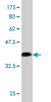 1 - RP2 Antibody (monoclonal) (M01) AT3695a
