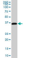 1 - RP2 Antibody (monoclonal) (M01) AT3695a
