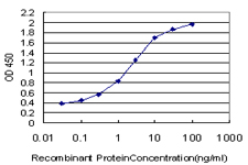 10 - RP2 Antibody (monoclonal) (M02) AT3696a