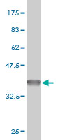 1 - RP2 Antibody (monoclonal) (M02) AT3696a