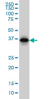 1 - RP2 Antibody (monoclonal) (M02) AT3696a
