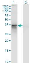 1 - RP2 Antibody (monoclonal) (M02) AT3696a