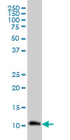 1 - RPA3 Antibody (monoclonal) (M01) AT3699a