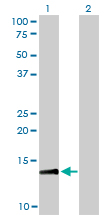 1 - RPA3 Antibody (monoclonal) (M01) AT3699a