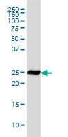 1 - RPL19 Antibody (monoclonal) (M01) AT3704a