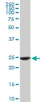 1 - RPL19 Antibody (monoclonal) (M01) AT3704a