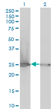 1 - RPL19 Antibody (monoclonal) (M01) AT3704a