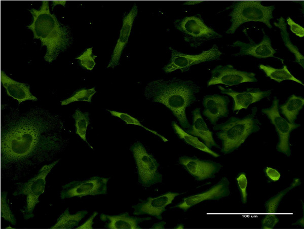 3 - RPL36A Antibody (monoclonal) (M01) AT3706a