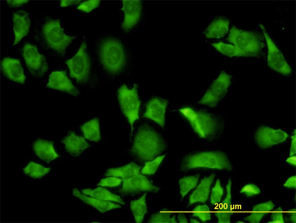 3 - RPL36A Antibody (monoclonal) (M02) AT3707a