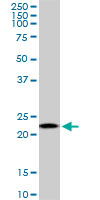 1 - RPS5 Antibody (monoclonal) (M01) AT3718a
