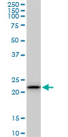 1 - RPS5 Antibody (monoclonal) (M01) AT3718a