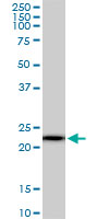 1 - RPS5 Antibody (monoclonal) (M01) AT3718a