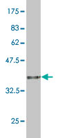 1 - RPS5 Antibody (monoclonal) (M02) AT3719a