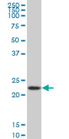 1 - RPS5 Antibody (monoclonal) (M02) AT3719a