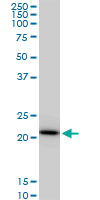 1 - RPS5 Antibody (monoclonal) (M02) AT3719a