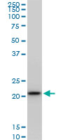 1 - RPS5 Antibody (monoclonal) (M02) AT3719a