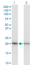 1 - RPS5 Antibody (monoclonal) (M02) AT3719a