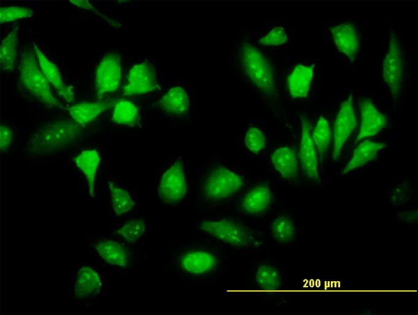 3 - RPS5 Antibody (monoclonal) (M02) AT3719a