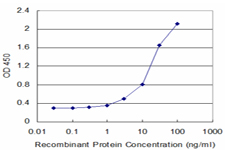 10 - RPS5 Antibody (monoclonal) (M02) AT3719a